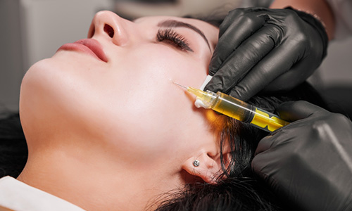 تزریق PRP تزریق PRP