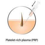 prp-icon