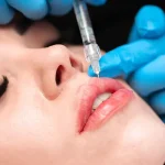 تزریق ژل و فیلر