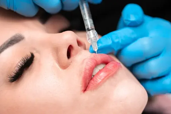 تزریق ژل و فیلر