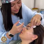 تزریق بوتاکس