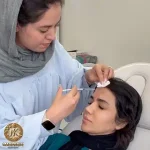 تزریق بوتاکس