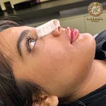 تزریق ژل و فیلر، کلینیک زیبایی مهدخت
