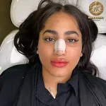 تزریق ژل و فیلر، کلینیک زیبایی مهدخت