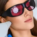 لیزر موهای زائد