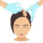 hair filler هیرفیلر hair filler هیرفیلر