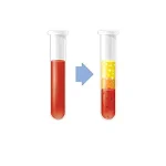 PRP غیر تزریقی PRP غیر تزریقی