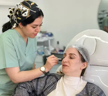 رفع خطوط دور چشم