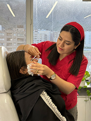 تزریق بوتاکس دور چشم تزریق بوتاکس دور چشم