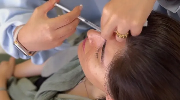 رفع خط اخم با بوتاکس