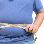 کاهش وزن بدون جراحی