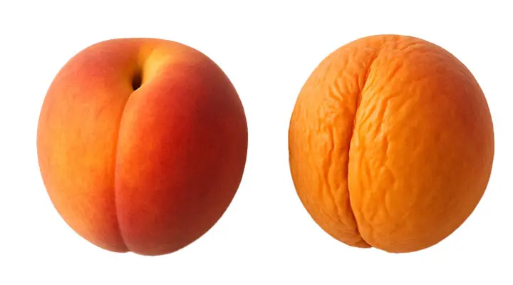 تزریق فیلر بیکینی