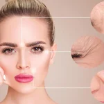 اگزوزوم تراپی