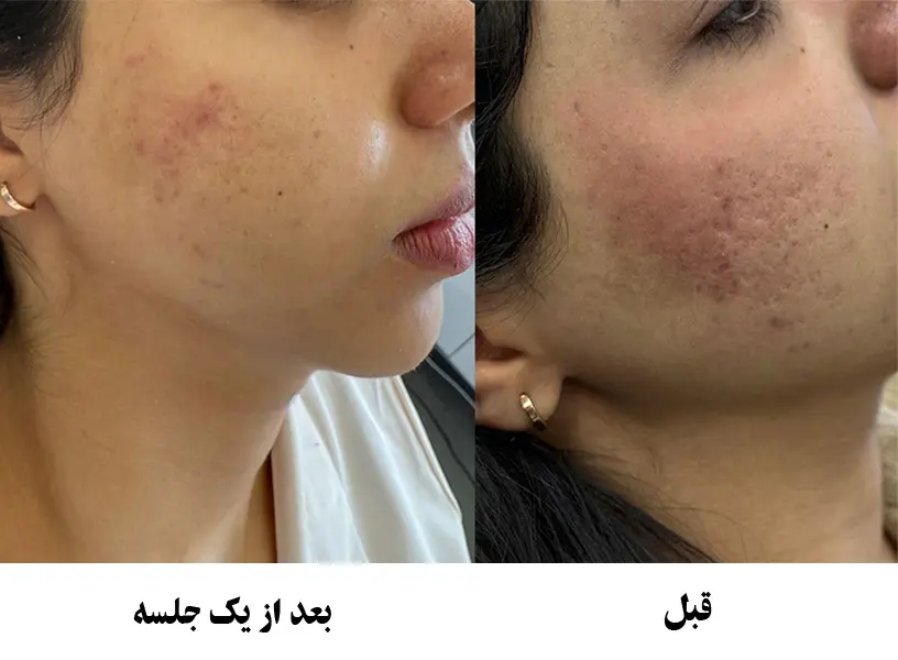 سابسیژن سابسیژن