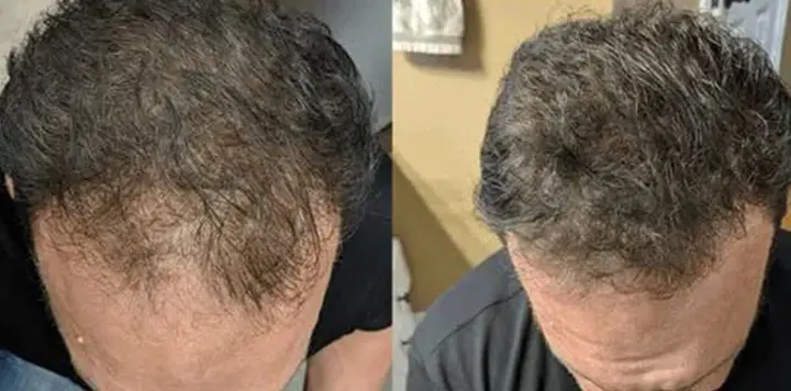 اگزوتک مو اگزوتک مو