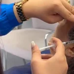 بوتاکس میگرن