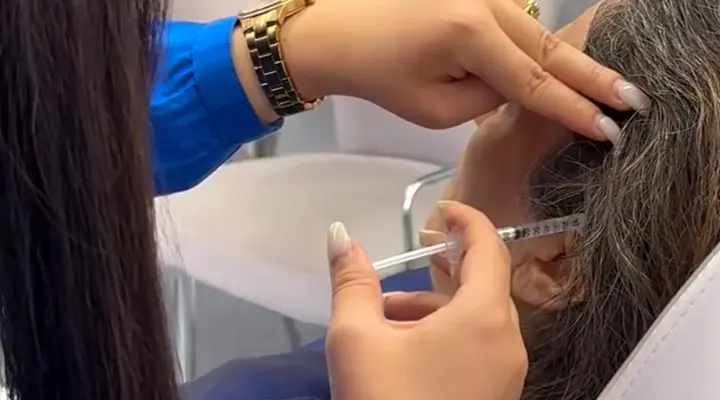 بوتاکس میگرن