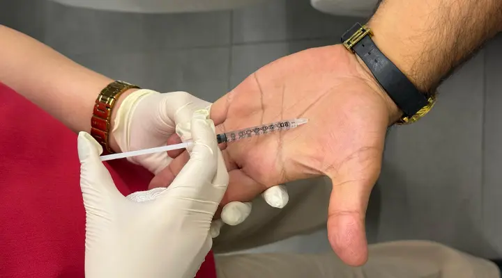 بوتاکس کف دست